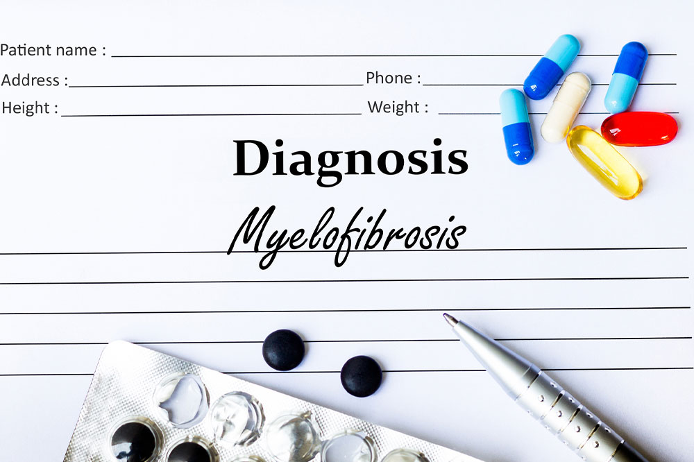 Myelofibrosis – Symptoms, causes, and management options